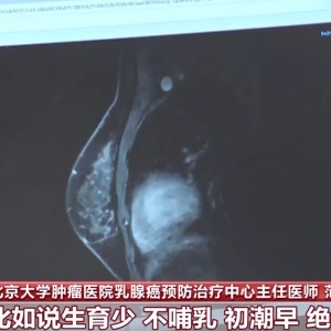 全球每分钟4名女性确诊！发病率逐年上升 怎样才能防患于未然? ...