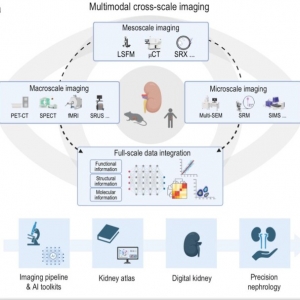 我国科学家计划打造“数字肾脏” 让肾脏疾病“清晰可见”