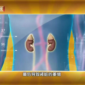 快自查！手机壳选不对等于“毒源”在手上 如有这些特征快扔掉 ...