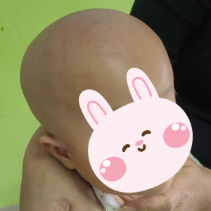 6个月“大头宝宝”跨城求医 刷新湘潭市中心医院最低龄V-P分流纪录 ...